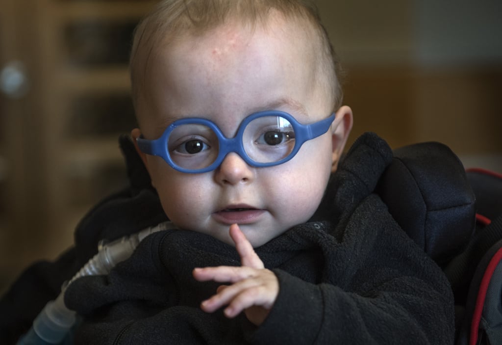 A 1 pound baby patient